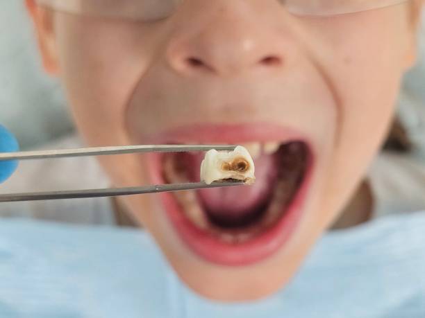 Best Emergency Treatment for Toothache in Bethel, OH